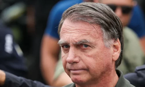 JAIR BOLSONARO APRESENTA MELHORA CLÍNICA E RECUPERAÇÃO RENAL, MAS SEGUE NA UTI